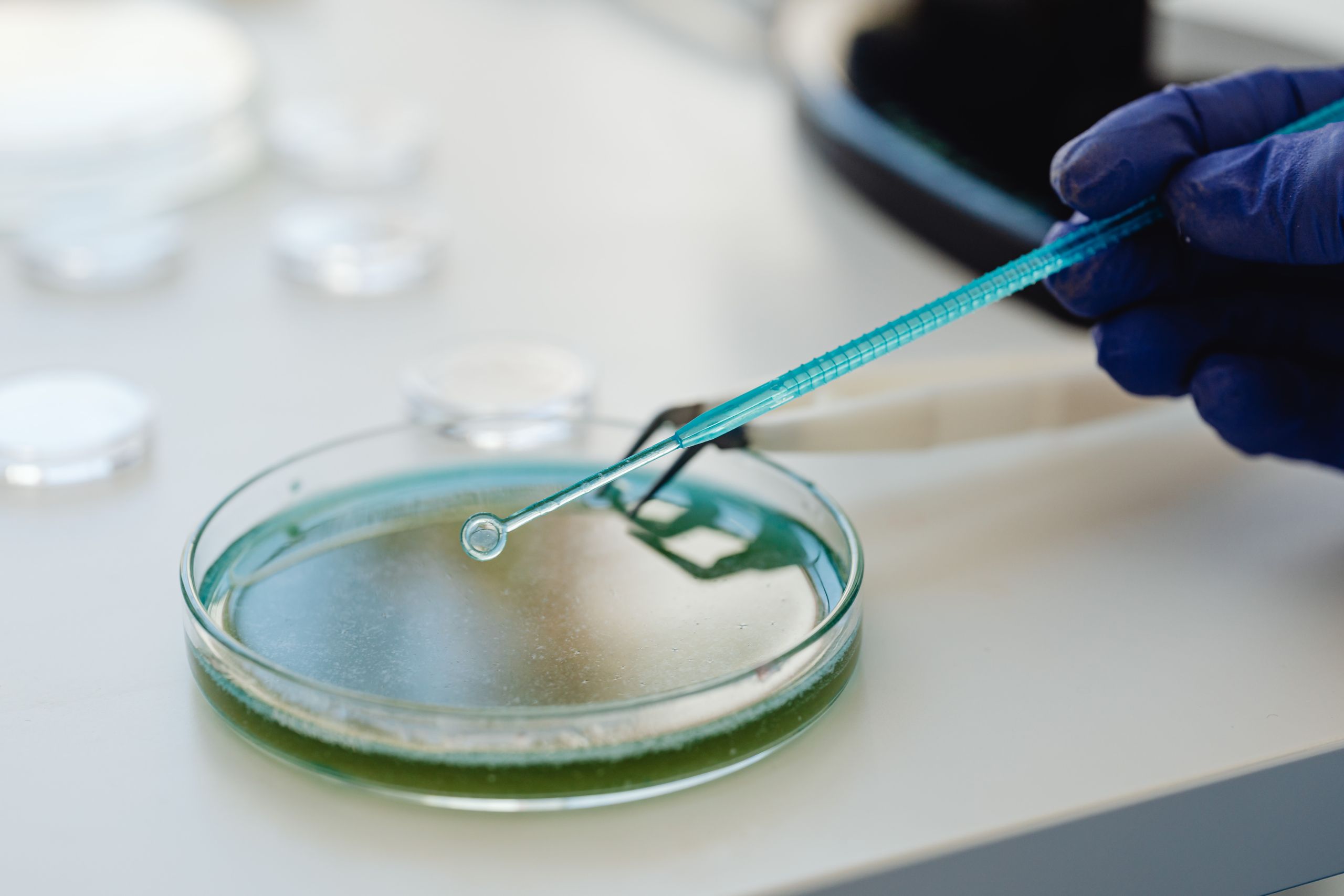 Estudio in vitro.